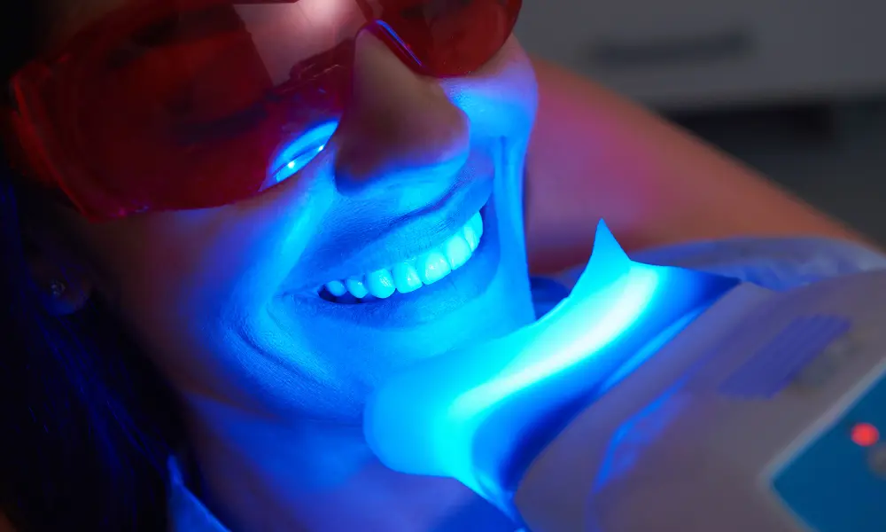 Sorriso luminoso e dentes mais claros como resultado dos benefícios do branqueamento dentário.