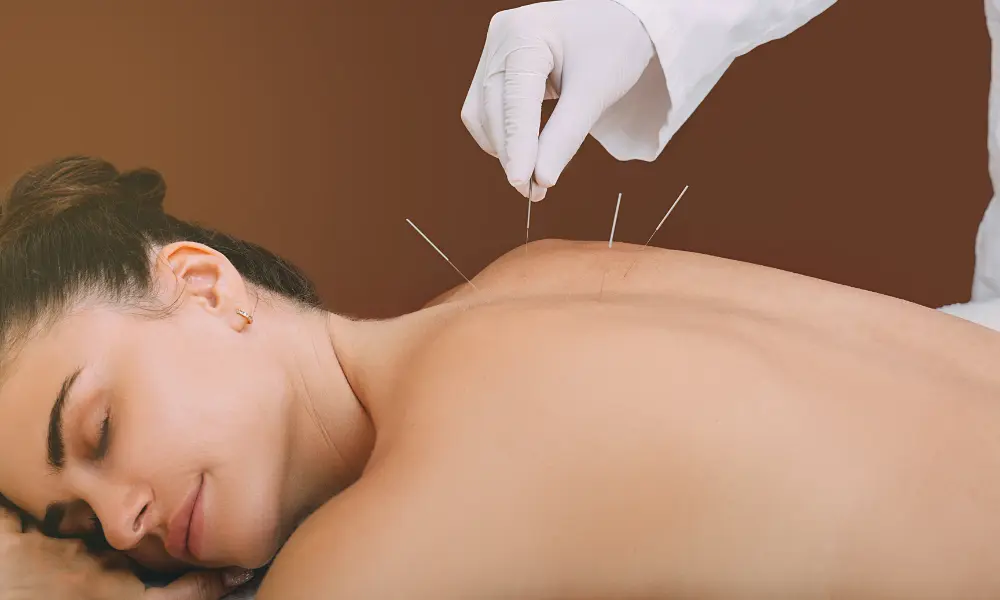 Sessão de acupuntura da Medicina Tradicional Chinesa para aliviar dor crónica e promover bem-estar físico e emocional.