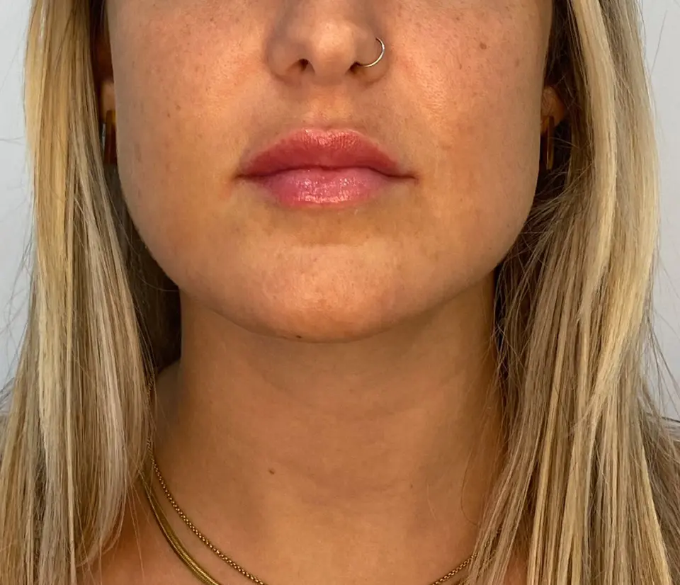 estética facial