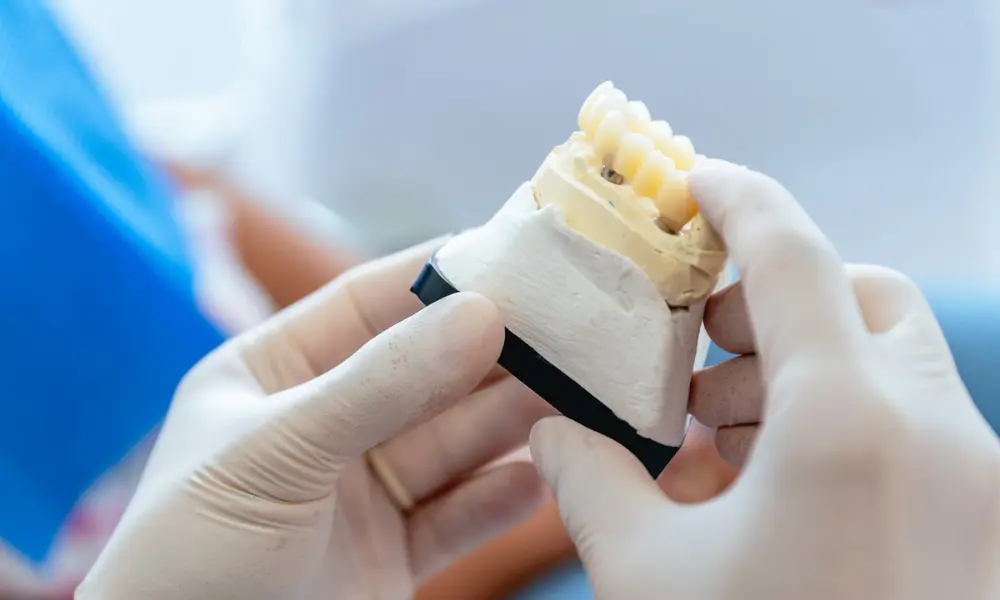 As próteses dentárias fixas oferecem estabilidade, estética natural, conforto, durabilidade e uma função mastigatória semelhante à dos dentes verdadeiros, sendo uma das soluções mais eficazes para reabilitação oral.