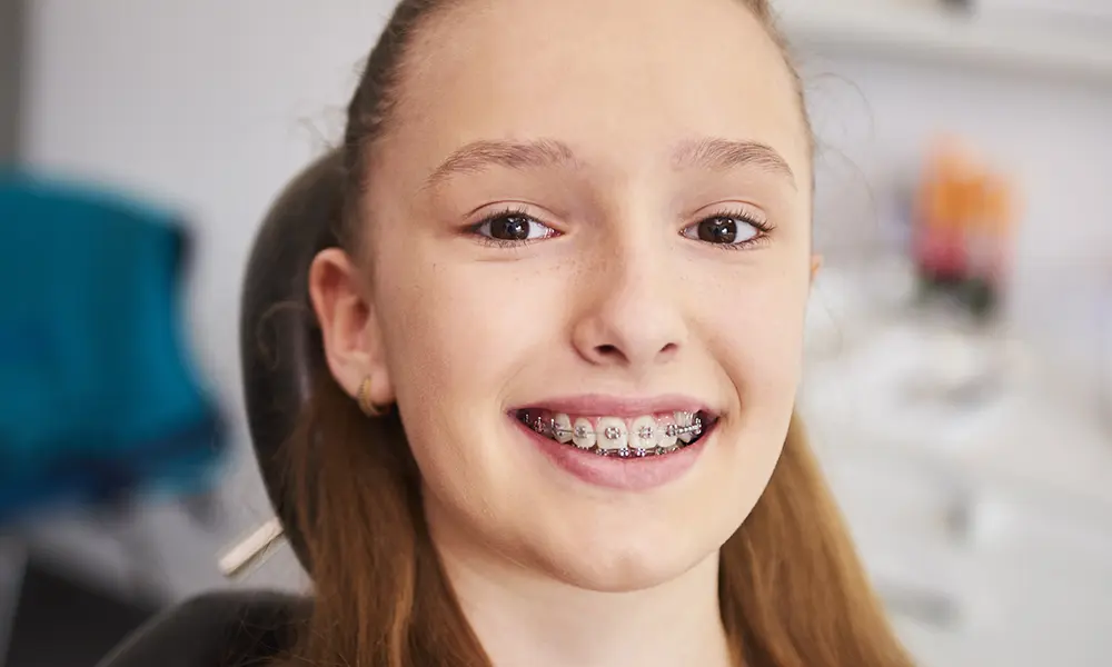 Que Aparelho Dentário Devo Escolher? Entenda neste artigo a diferença entre o aparelho autoligado e o convencional. Consulte o seu dentista!