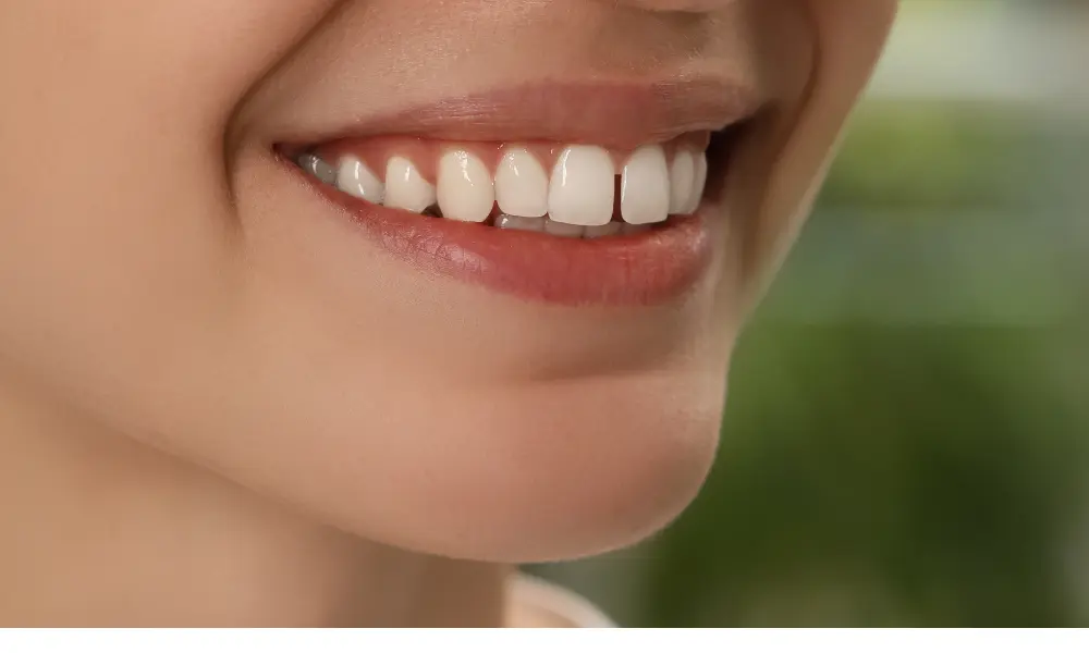 O diastema pode ser tratado com ortodontia, alinhadores transparentes, resinas compostas, facetas dentárias ou frenectomia quando o freio labial impede o fecho do espaço.