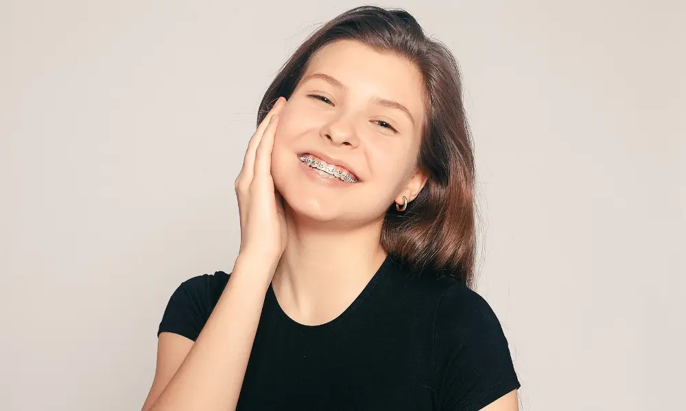 Cuidados com aparelho ortodôntico fixo, higiene oral correta que previne manchas brancas e inflamação das gengivas.