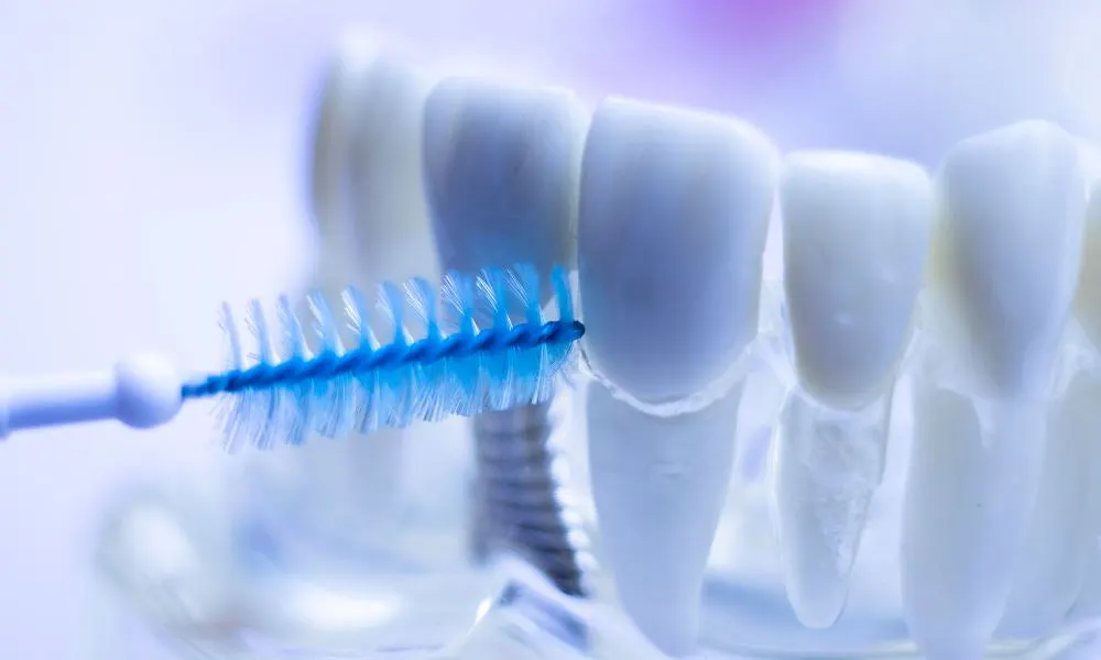 Higiene para evitar manchas brancas nos dentes