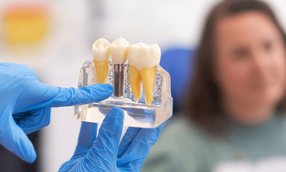 como-se-coloca-um-implante-dentario na clínica catassol na maia