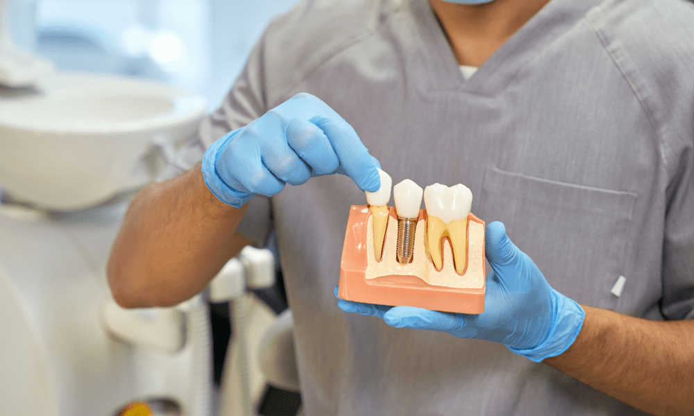 como-se-coloca-um-implante-dentario na clínica catassol na maia