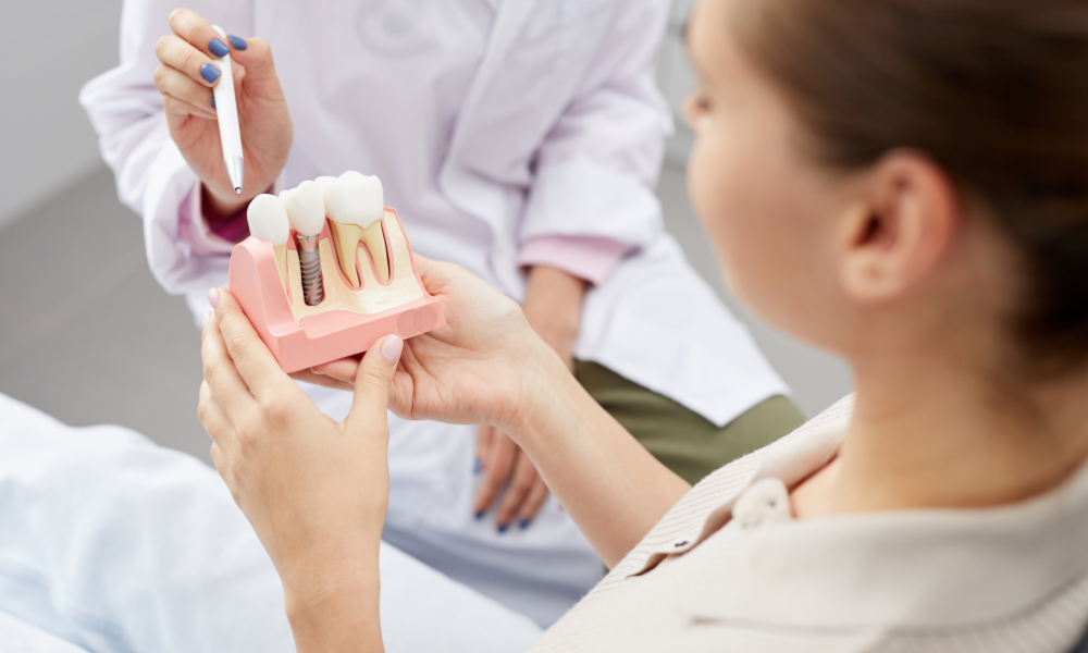 implantes-dentarios-carga-imediata