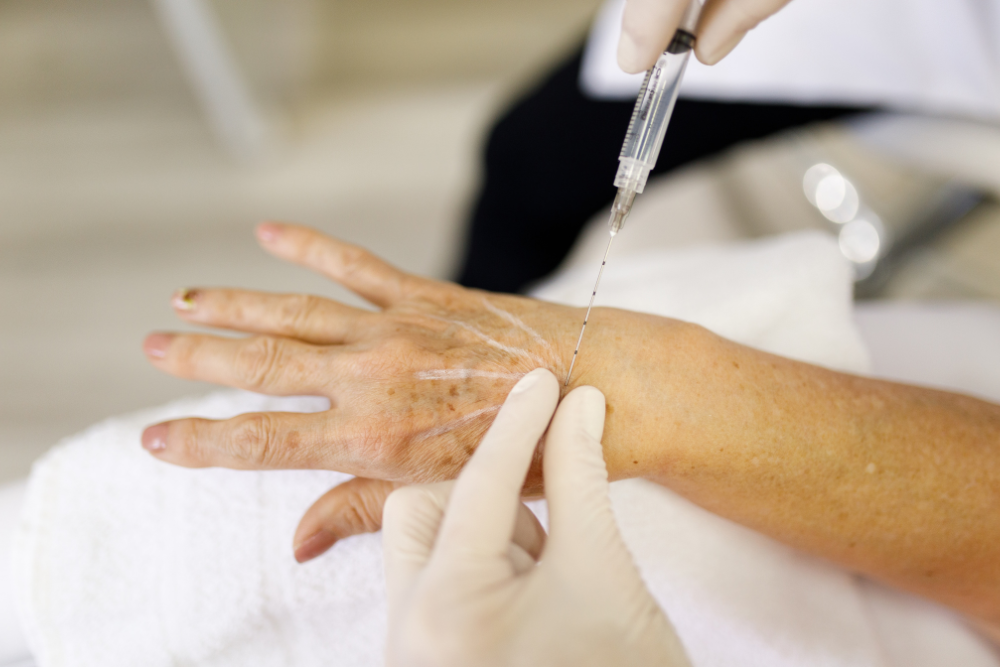 bioestimuladores-clinica-catassol