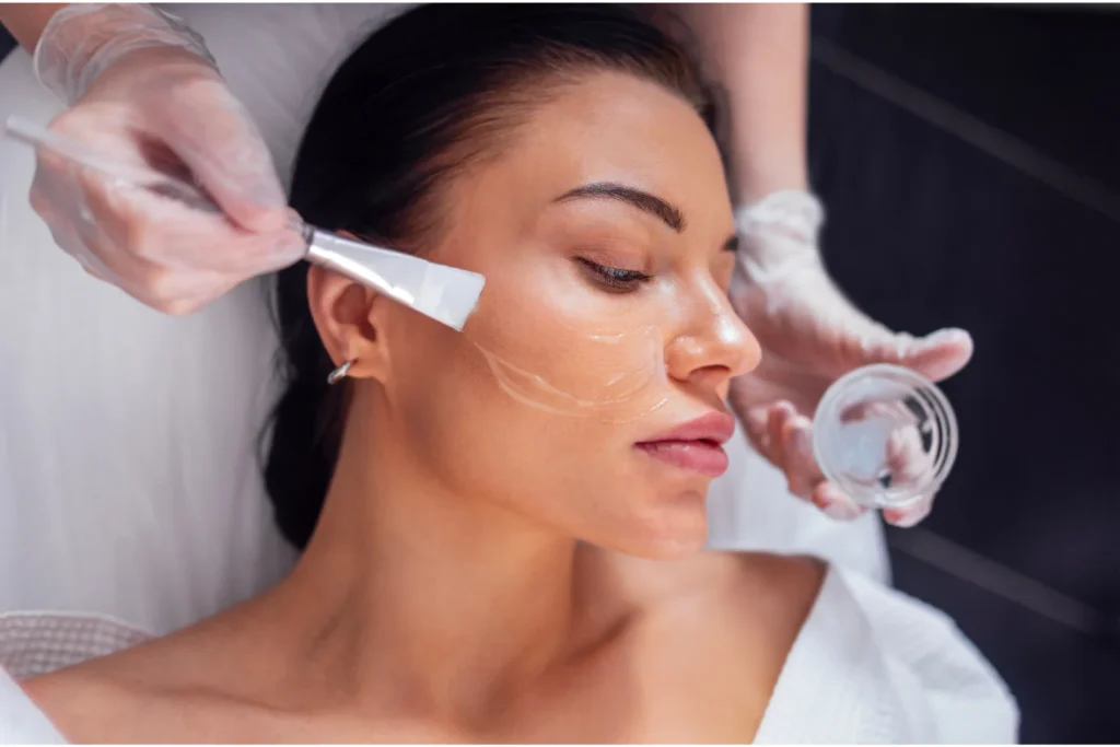 peeling-quimico-clinica-do-catassol